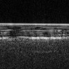Marsa pazemes ezers radara attēlā (apakšējais gaišais slānis )